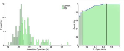 Automatic Quantification of Interstitial Lung Disease From Chest Computed Tomography in Systemic Sclerosis